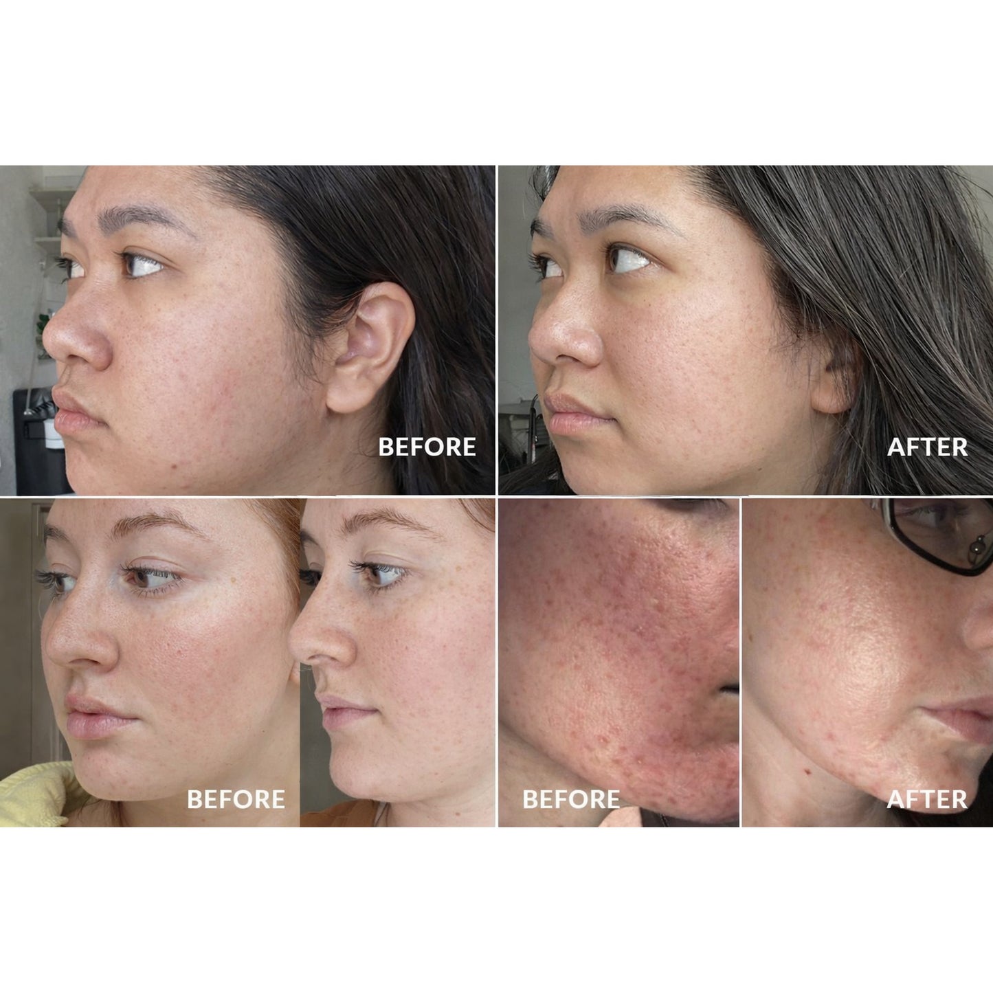 PureSonic™ Deep Clean Device